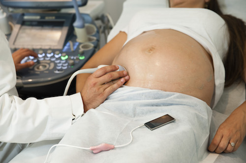 Фото 5. Інтравагінальний музичний апарат для вагітних - Babypod Бебіпод